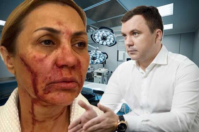 «Элитный хирург» с поддельной репутацией: кем на самом деле является изуродовавший мать Виктории Бони Максим Иванчук?